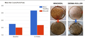 Screenshot 2026-03-23 104900.png